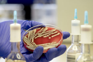 Escherichia coli (E. coli) colonies in a lab