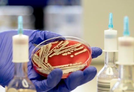 Escherichia coli (E. coli) colonies in a lab