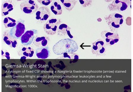 CDC image of Naegleria fowler brain-eating amoeba from CDC website