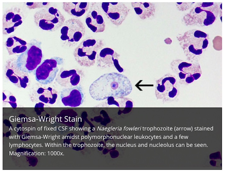 CDC image of Naegleria fowler brain-eating amoeba from CDC website