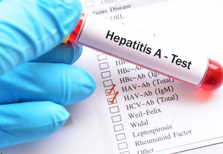 Hepatitis A virus (HAV) test