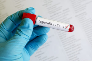 Blood sample with legionella positive