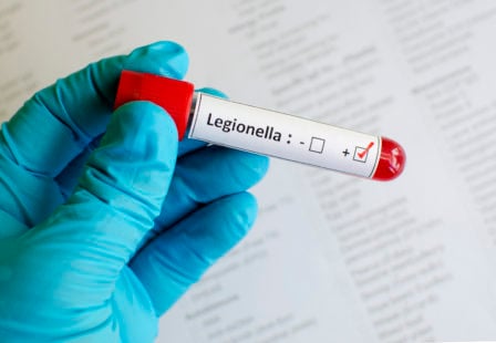 Blood sample with legionella positive