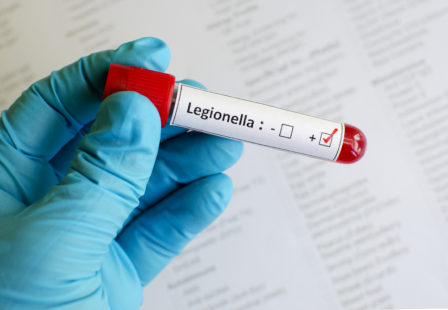 Legionnaires' disease