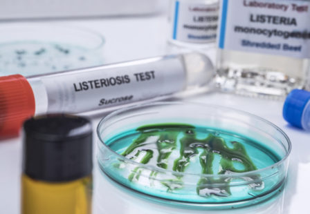 Listeria test for lawsuit