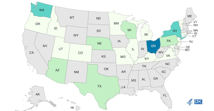 Busetto Charcuterie Platter Salmonella Outbreak