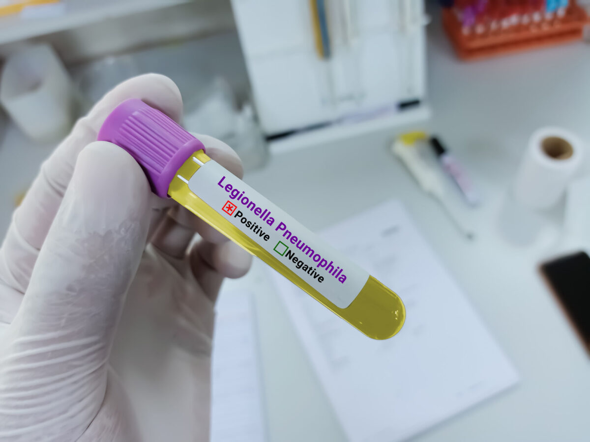 Scientist holding a urine sample for Legionella antigen test