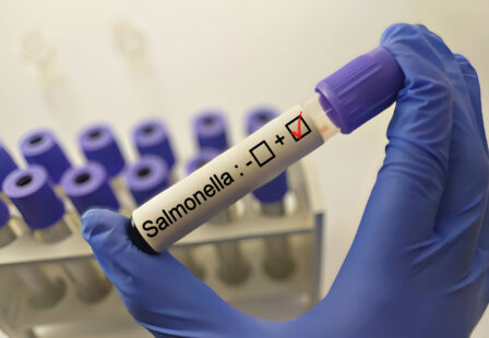 Diagnostician holding in hand a positive Salmonella bacteria test
